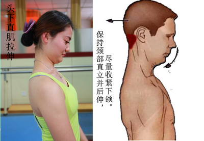 肌筋膜疼痛的精确治疗手法拉伸图解挂图